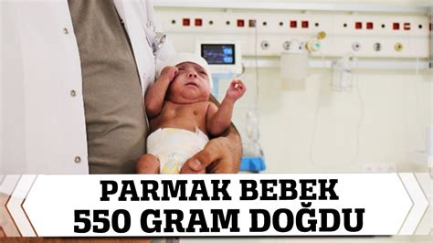 26 haftalık bebek erken doğdu kan şekeri yüksek